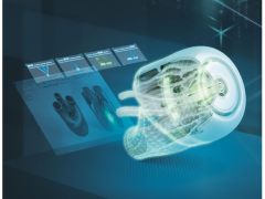 西門子向醫(yī)療服務(wù)提供商和醫(yī)學(xué)設(shè)計(jì)師 開(kāi)放增材制造網(wǎng)絡(luò)平臺(tái)